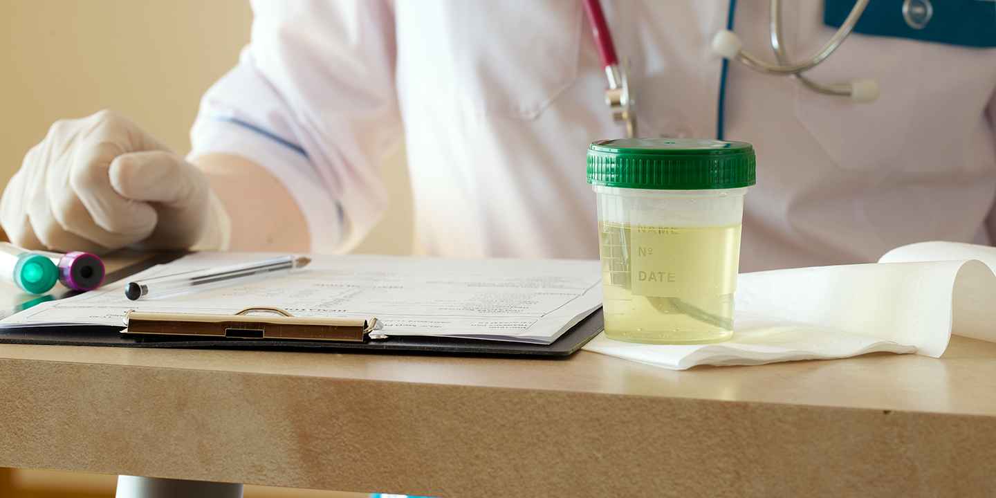 Urine Color Chart: Understanding What Your Urine Says About Your Health