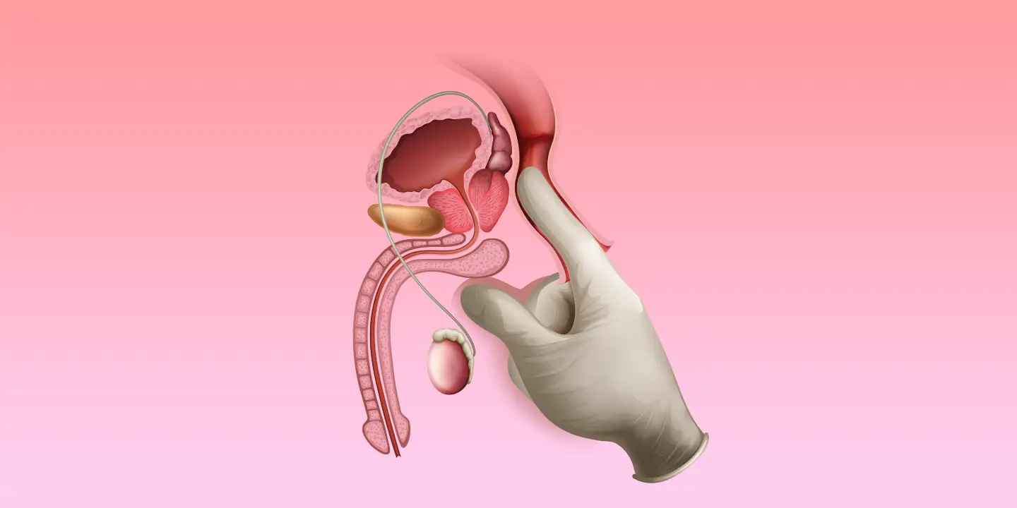 Hormone vs. Non-Hormone Therapies for Advanced Prostate Cancer