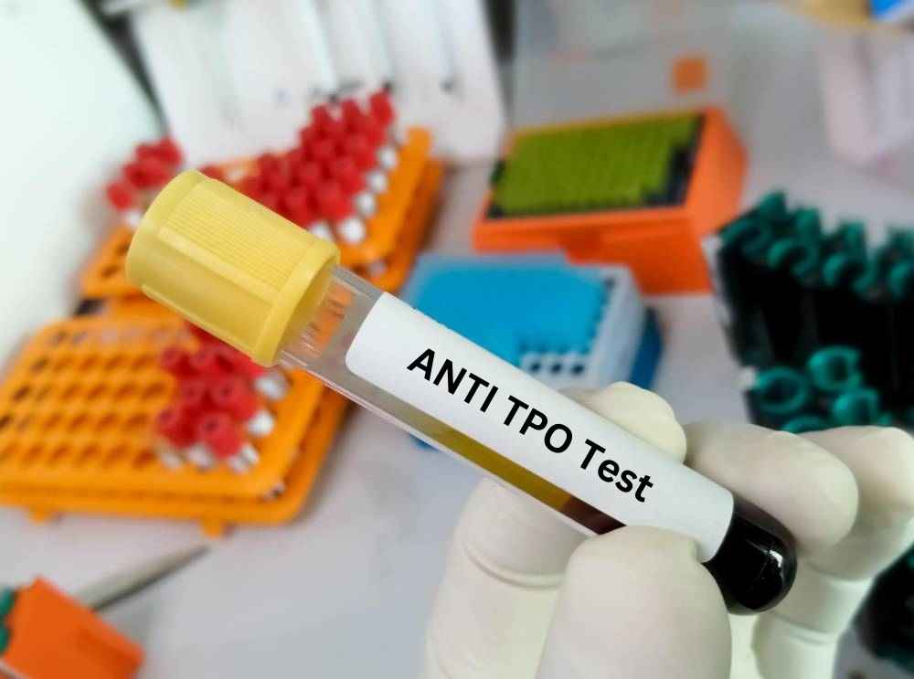 Anti TPO Test - Price, Range, Preparations, & Procedure - 2026