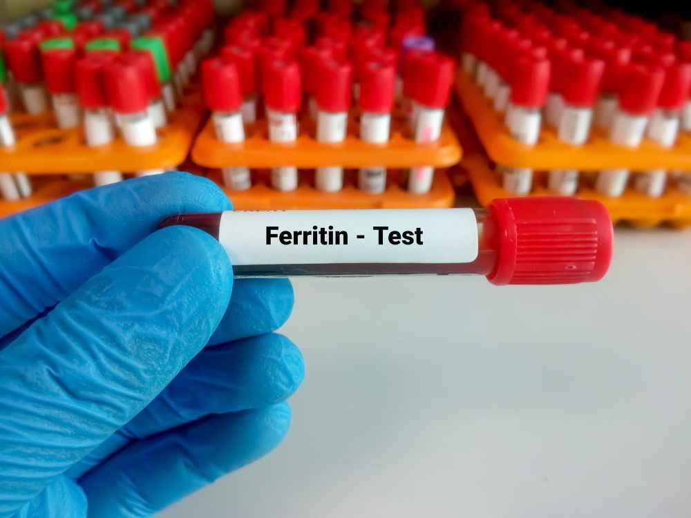 Ferritin Test - Price, Procedure, Preparations, Range 2026