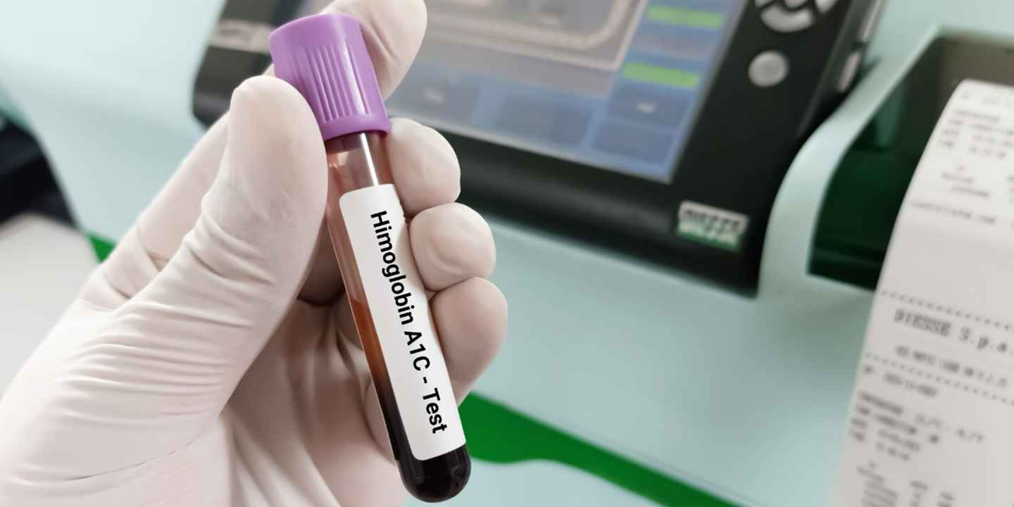 Understanding Your HbA1C Results for Diabetes?