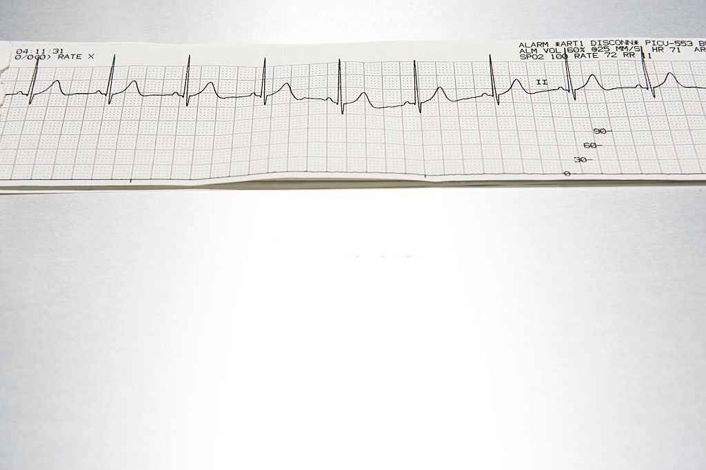 Echo Test: why is it done, ecg vs. echocardiography, results and more