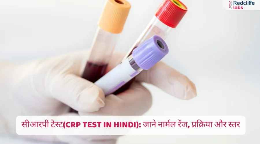 CRP Test in Hindi | सीआरपी टेस्ट क्या है, नार्मल रेंज, लक्षण और महत्व