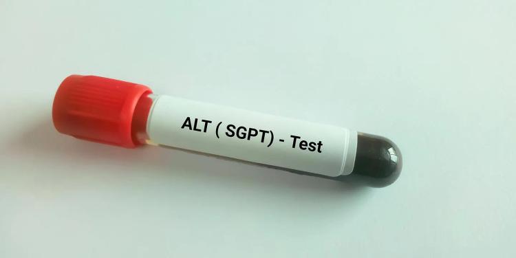SGPT Test in Hindi: महत्व, प्रक्रिया और सामान्य रेंज