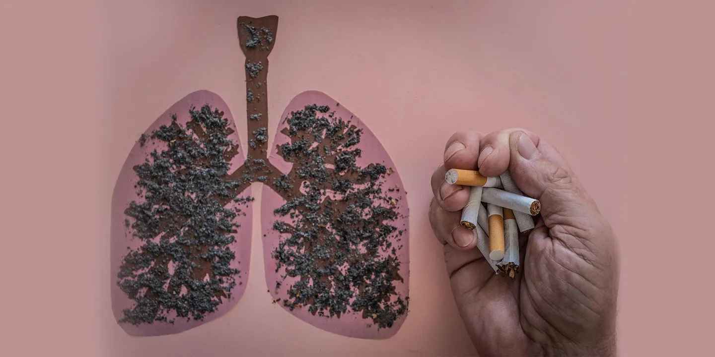 क्या धूम्रपान से छोटे सेल फेफड़ों का कैंसर होता है?