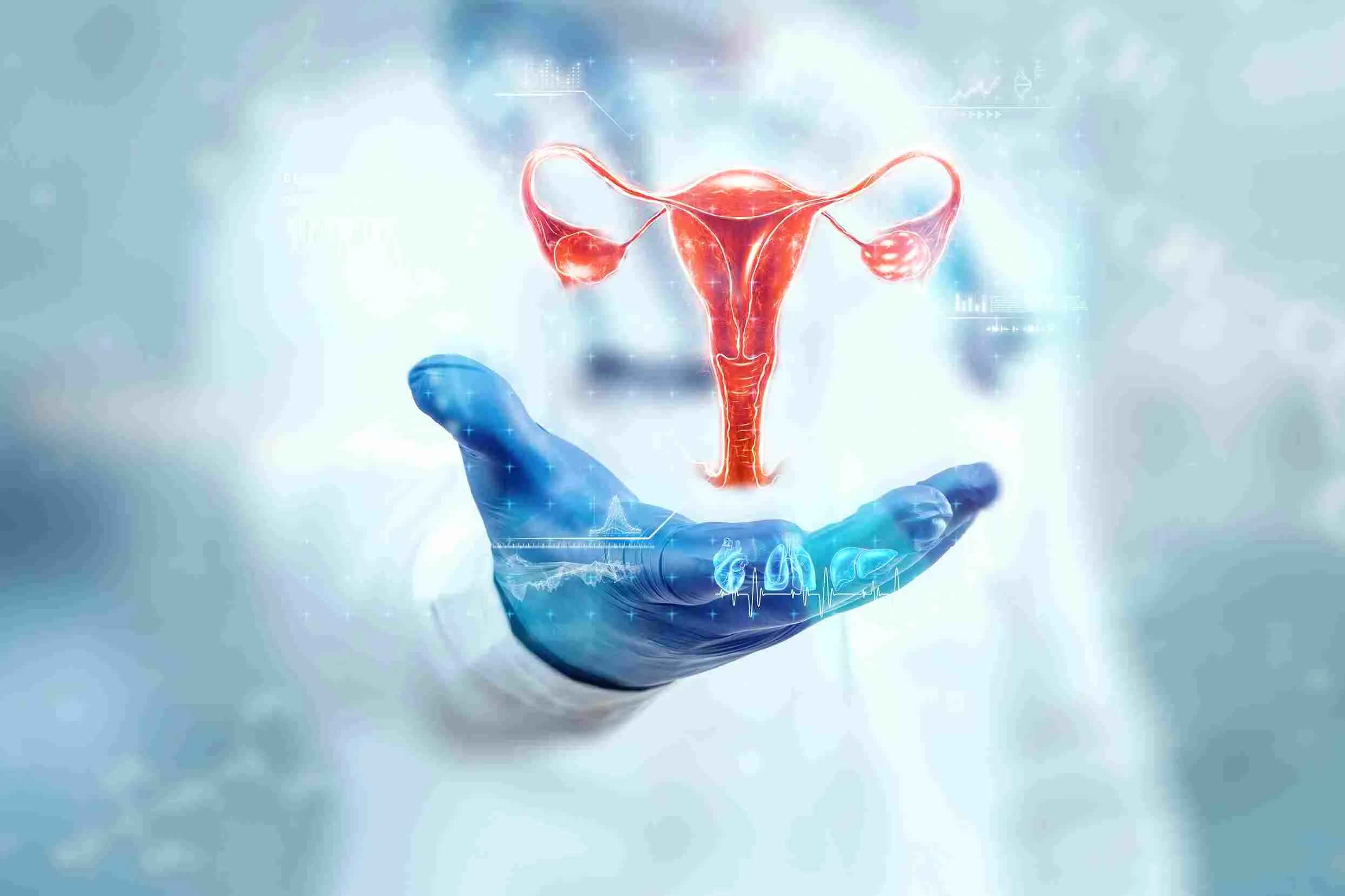 PCOS in Hindi - पीसीओएस (PCOS) क्या है ? लक्षण, कारण ,बचाव और उपचार