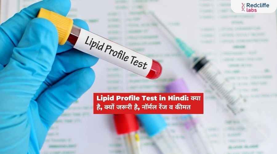 Lipid Profile Test in Hindi: क्या है, क्यों जरूरी है, नॉर्मल रेंज व कीमत