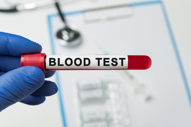 Blood Tests for Hepatitis: Detection and Diagnosis in 2026