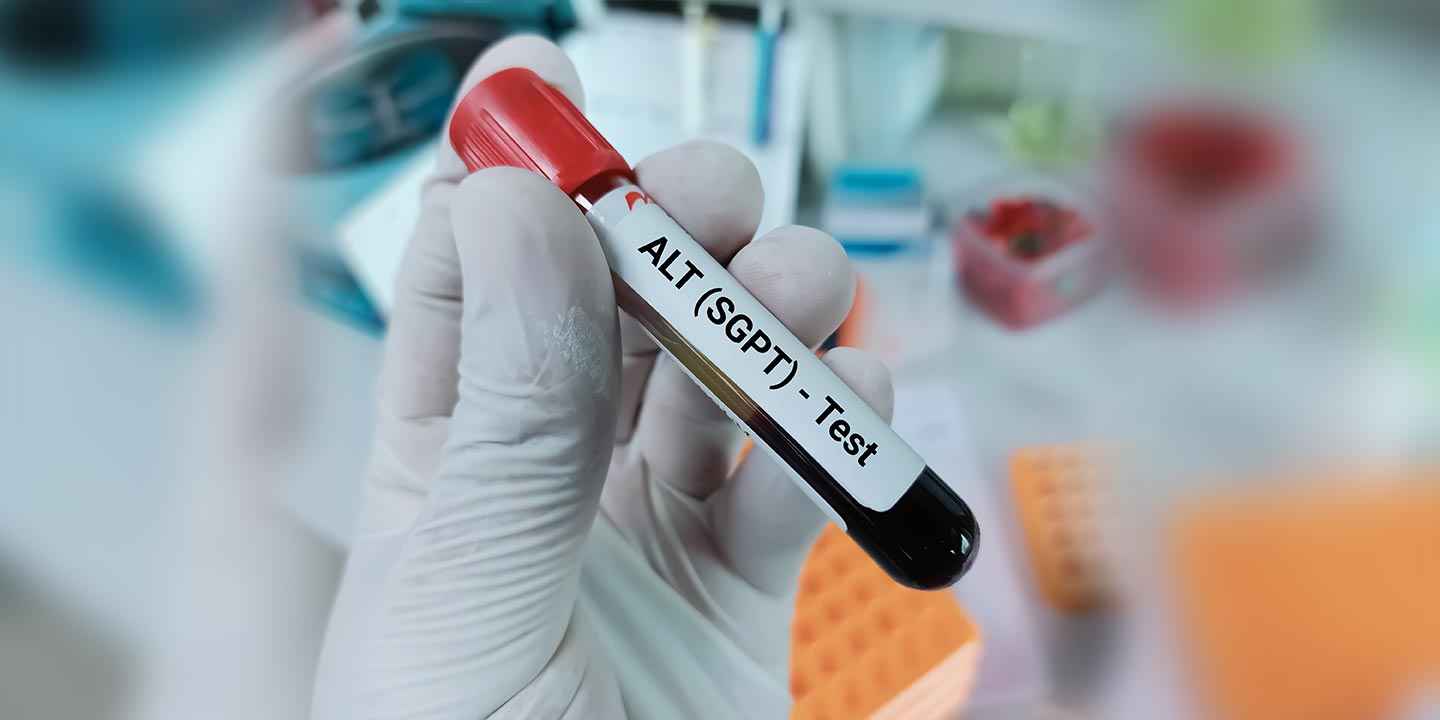 এসজিপিটি (SGPT) ও এসজিওটি (SGOT) পরীক্ষা