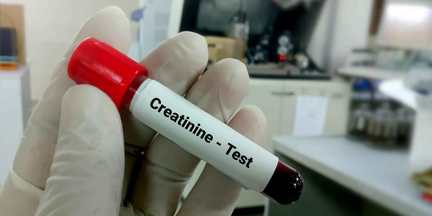 সিরাম ক্রিয়েটিনিন ও তার স্বাভাবিক পরিসীমা