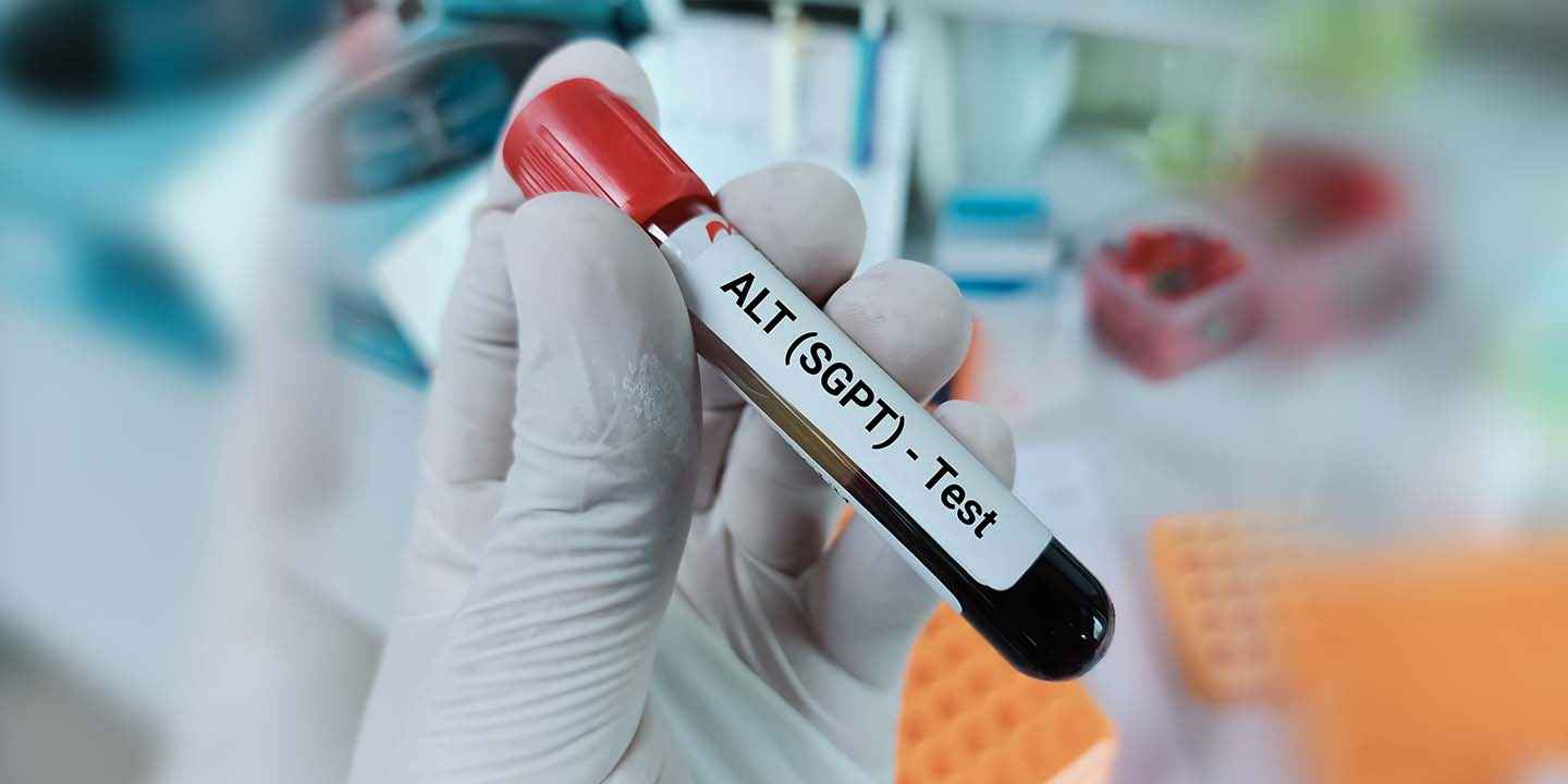 SGPT आणि SGOT चाचणी: सामान्य श्रेणी, त्याचे स्तर आणि ते काय सूचित करतात?