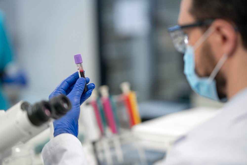 Total IgE Test - Price, Preparation, Procedure, Normal Range