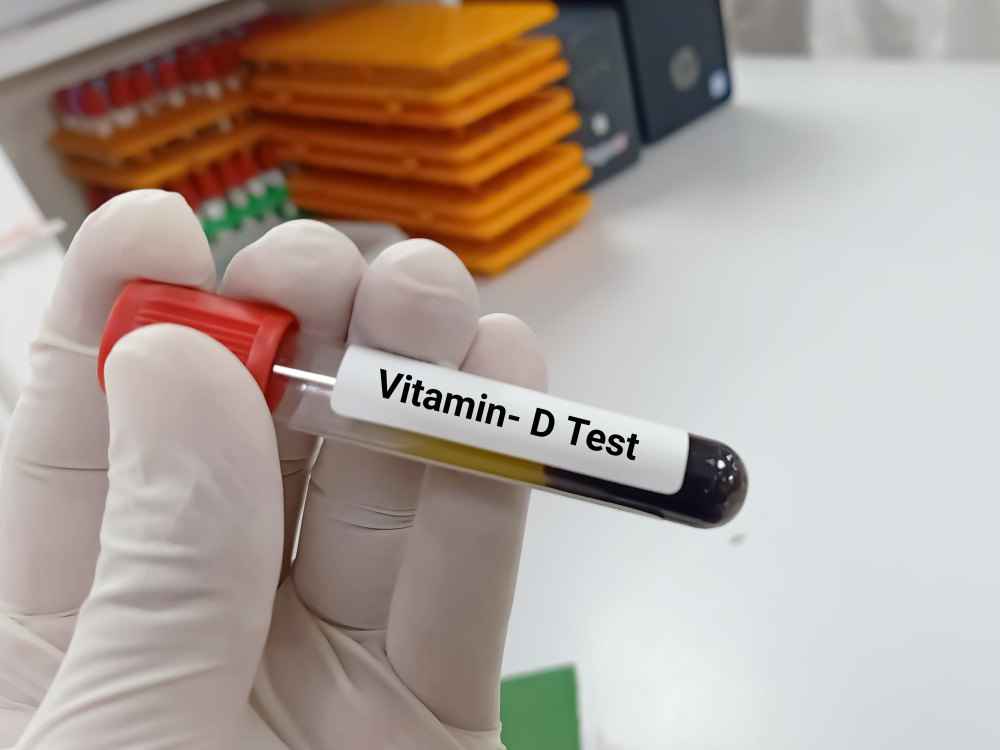 Vitamin D Test in Hindi - विटामिन डी टेस्ट कैसे, क्यों और कब कराये