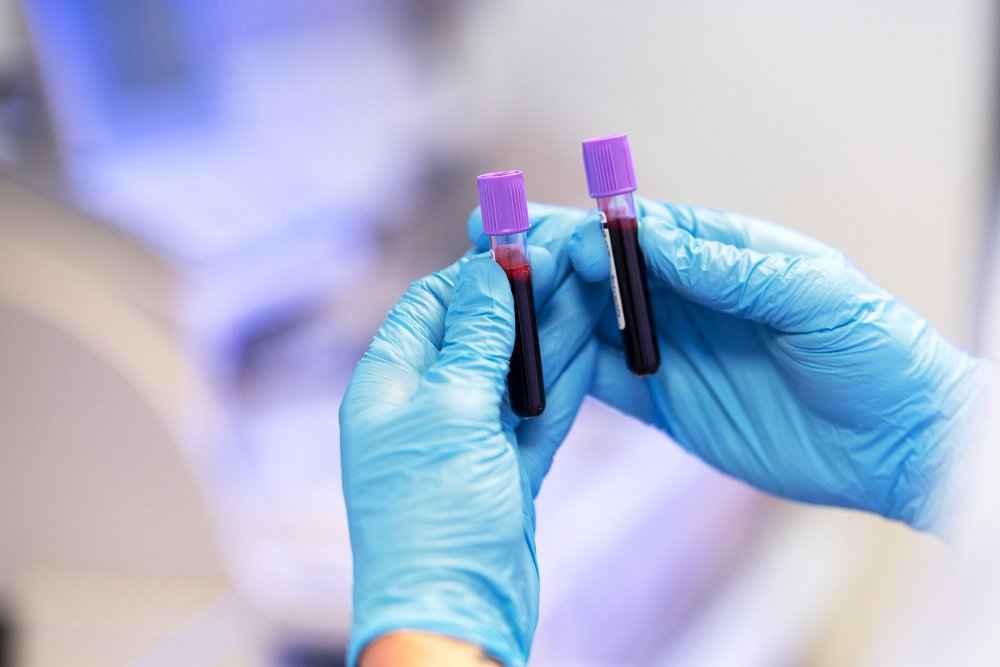 Important Blood Tests to Detect Stomach Infection