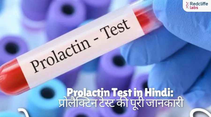Prolactin Test in Hindi: प्रोलैक्टिन टेस्ट की पूरी जानकारी