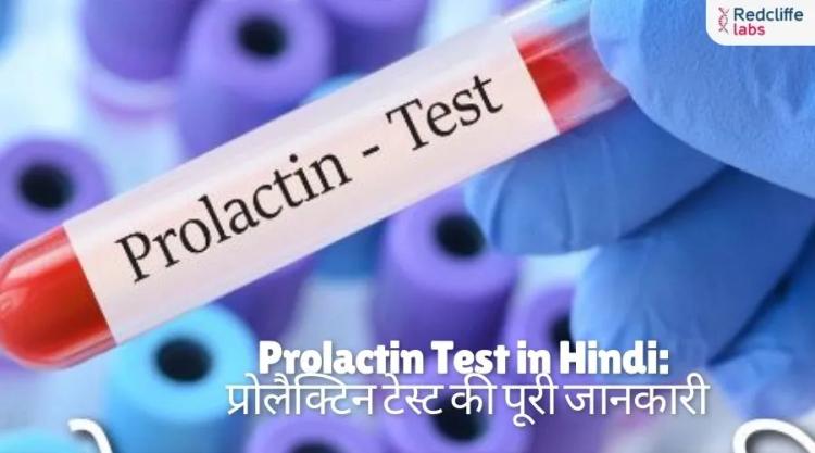 Prolactin Test in Hindi: प्रोलैक्टिन टेस्ट की पूरी जानकारी