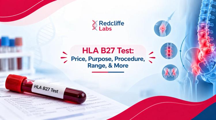 HLA B27 Test: Price, Purpose, Procedure, Range, & More