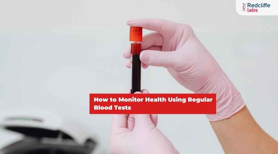 How to Monitor Health Using Regular Blood Tests?