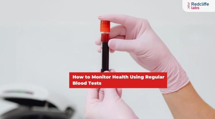 How to Monitor Health Using Regular Blood Tests?