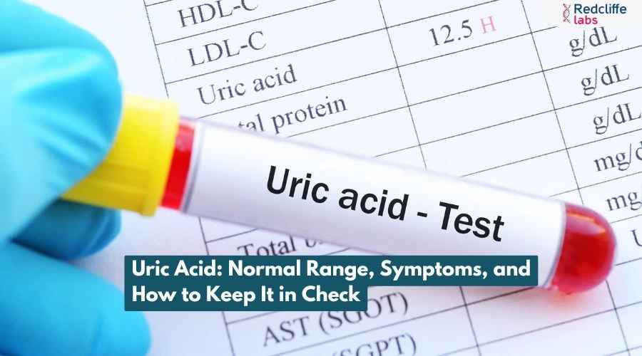 Uric Acid: Normal Range, Symptoms, and How to Keep It in Check