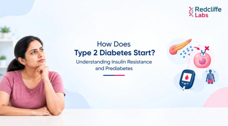 How Does Type 2 Diabetes Start? Understanding Insulin Resistance and Prediabetes