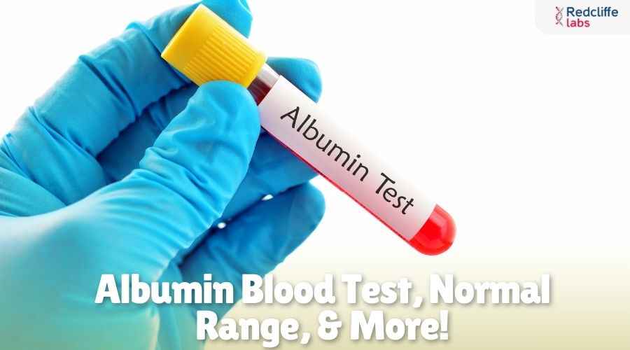 Albumin Blood Test: Normal Range, Procedure & More