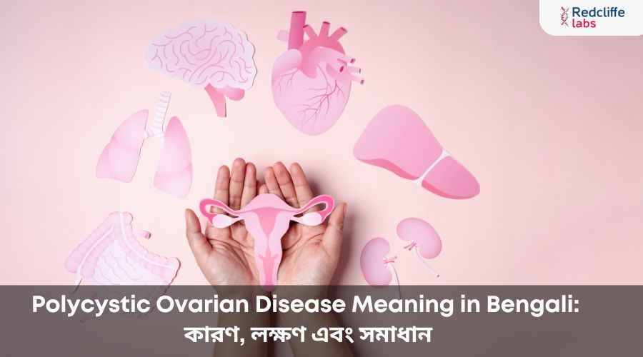 Polycystic Ovarian Disease Meaning in Bengali: কারণ, লক্ষণ এবং সমাধান