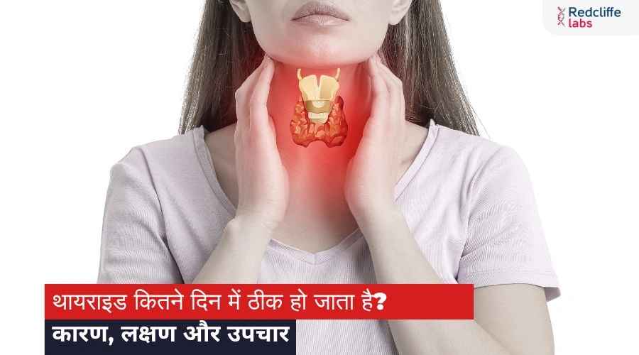थायराइड कितने दिन में ठीक हो जाता है? कारण, लक्षण और उपचार