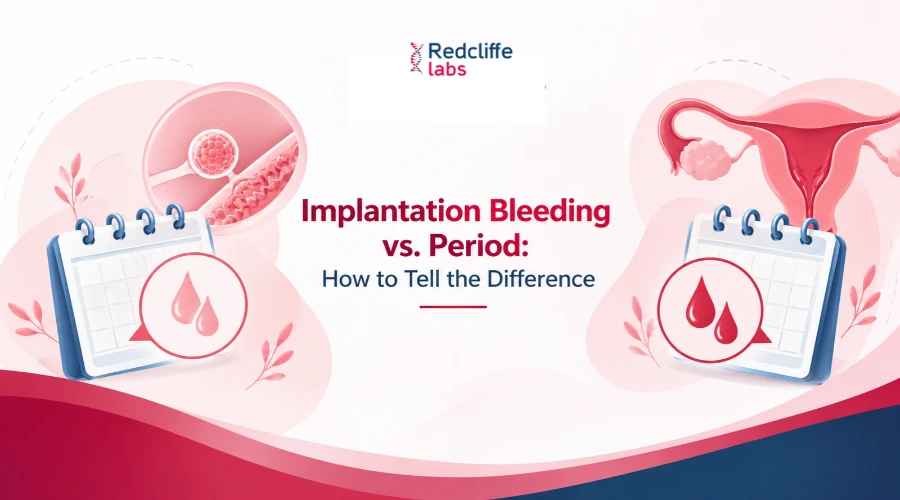 Implantation Bleeding vs. Period: How to Tell the Difference