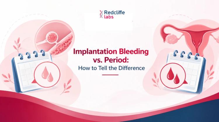 Implantation Bleeding vs. Period: How to Tell the Difference