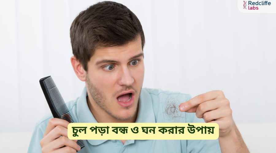 চুল পড়া বন্ধ ও ঘন করার উপায় - ঘরোয়া প্রতিকার ও কার্যকর টিপস