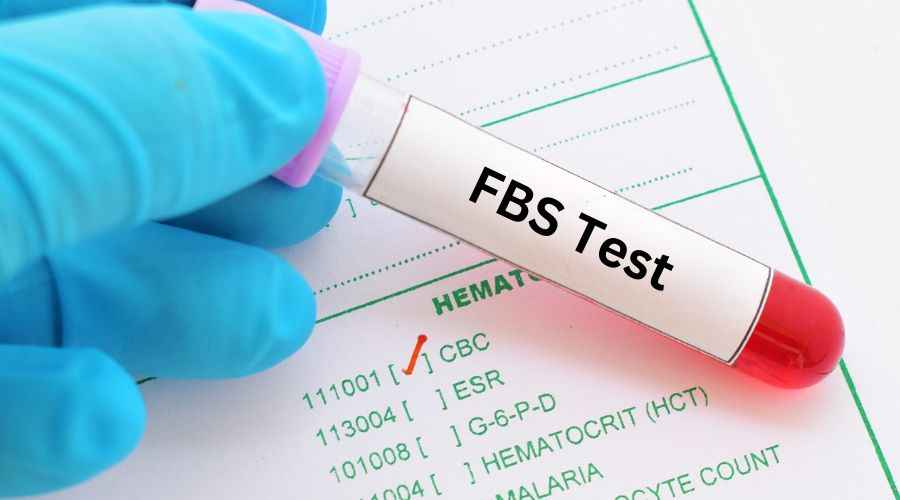 Frequency and Timing: When to Get an FBS Test