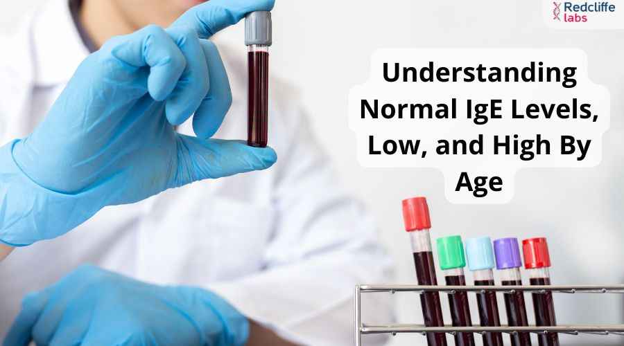 Understanding Normal IgE Levels, Low, and High By Age
