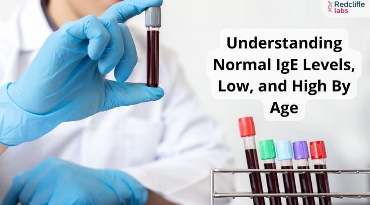 Understanding Normal IgE Levels, Low, and High By Age
