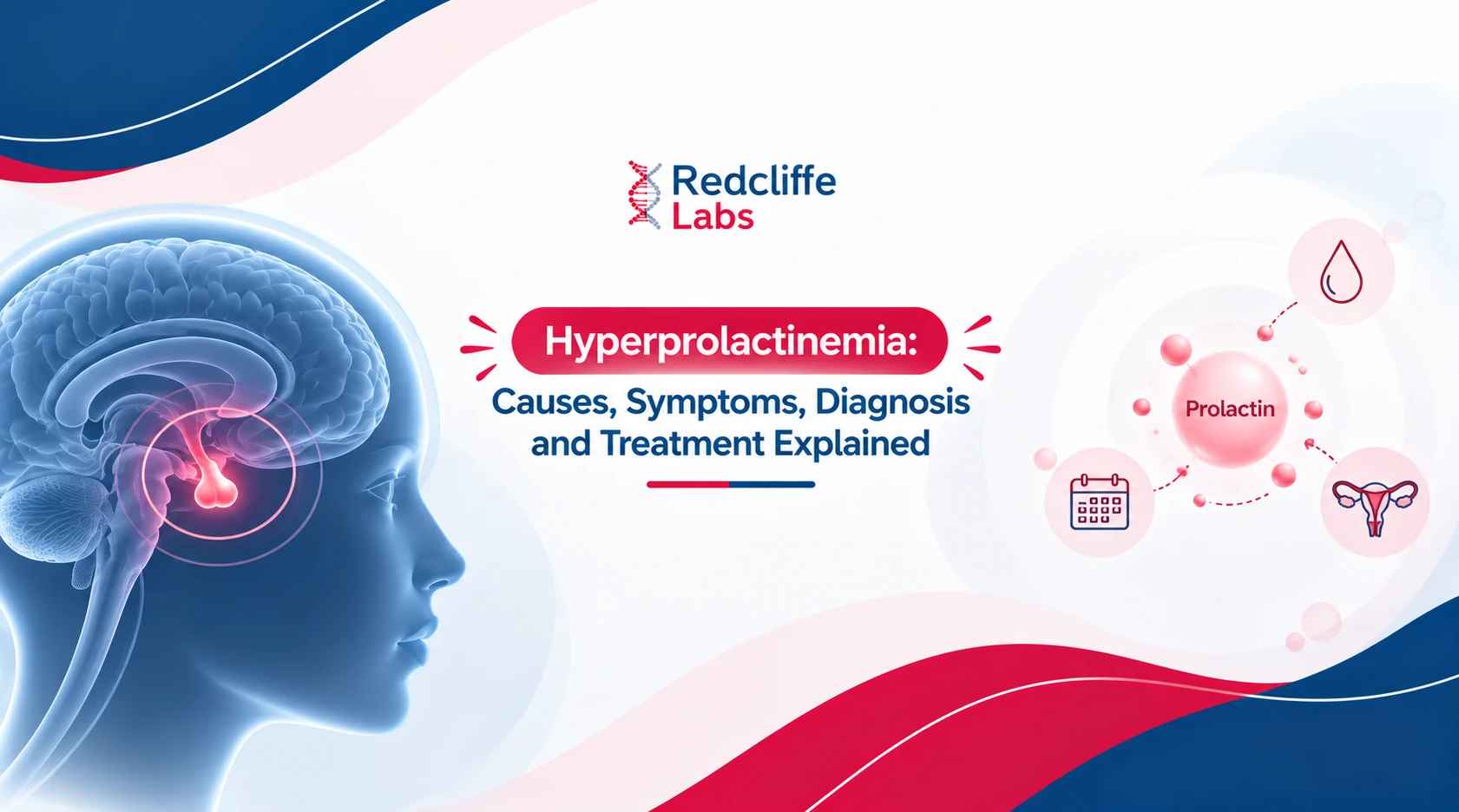 Hyperprolactinemia: Causes, Symptoms, Diagnosis and Treatment Explained