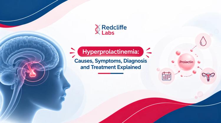 Hyperprolactinemia: Causes, Symptoms, Diagnosis and Treatment Explained