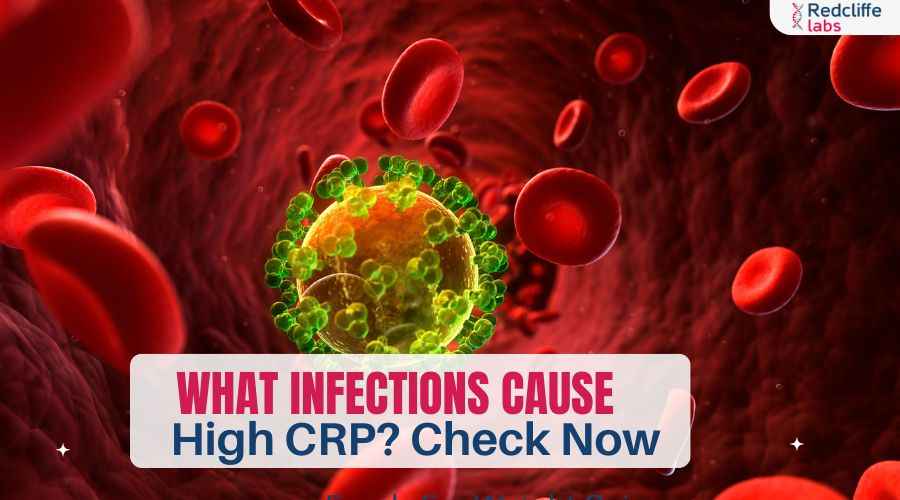 What Infections Cause High CRP? Check Now