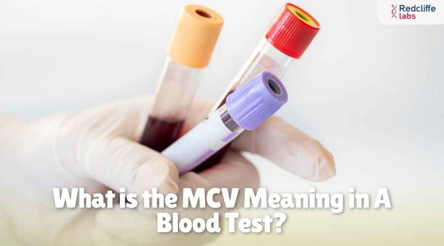 What is the MCV Meaning in A Blood Test?