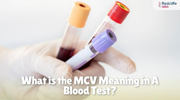 What is the MCV Meaning in A Blood Test?