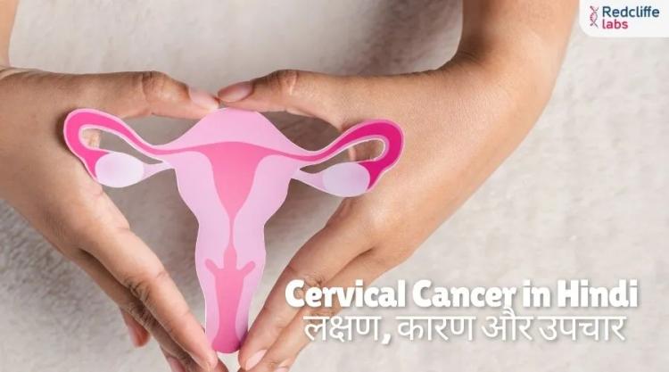 Cervical Cancer in Hindi: लक्षण, कारण और उपचार