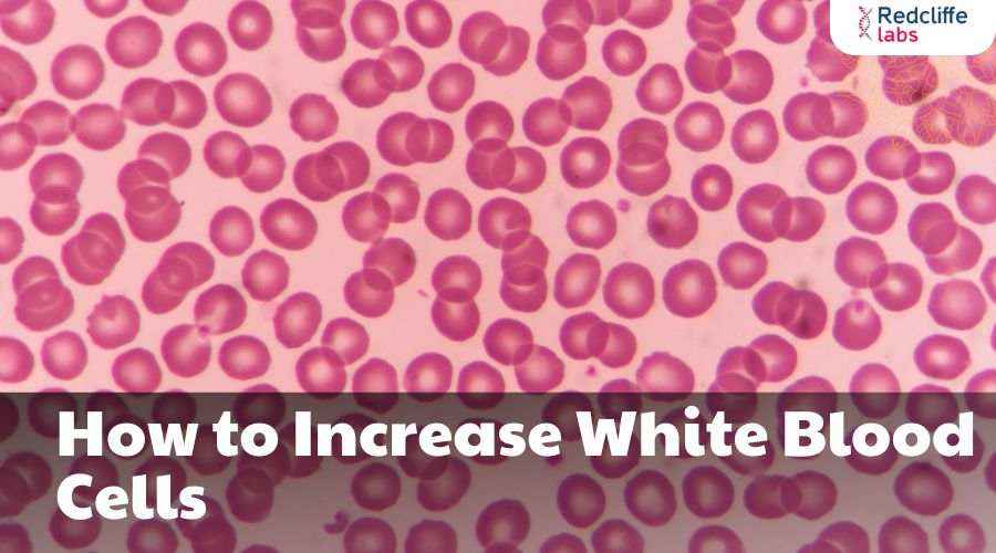 How to Increase White Blood Cells: Effective Natural Strategies