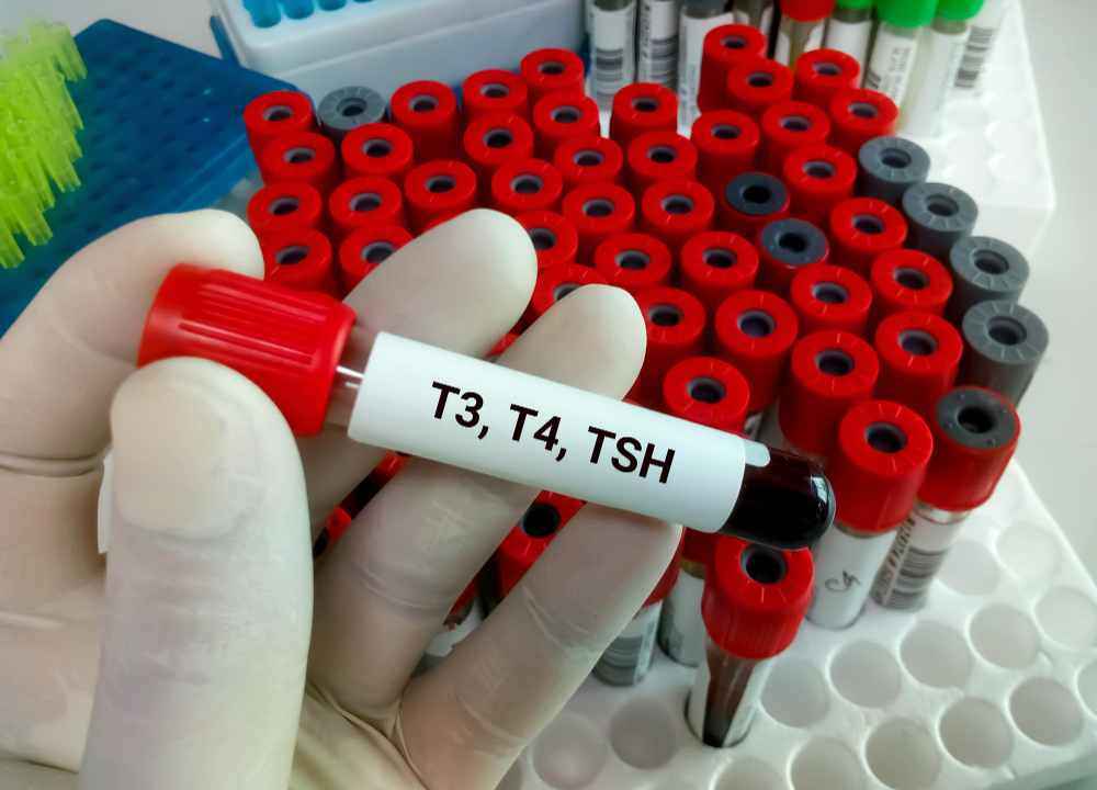 How do Total T3, Total T4, and TSH Ultra-Sensitive Help in Diagnosis?