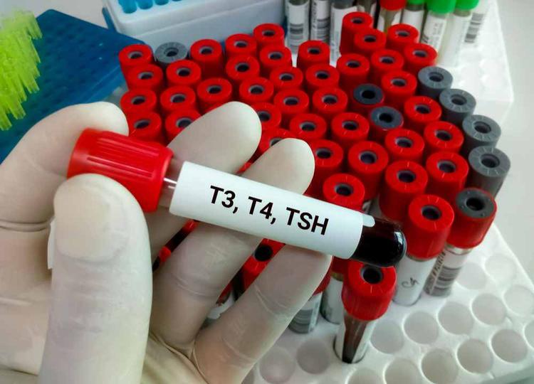 How do Total T3, Total T4, and TSH Ultra-Sensitive Help in Diagnosis?