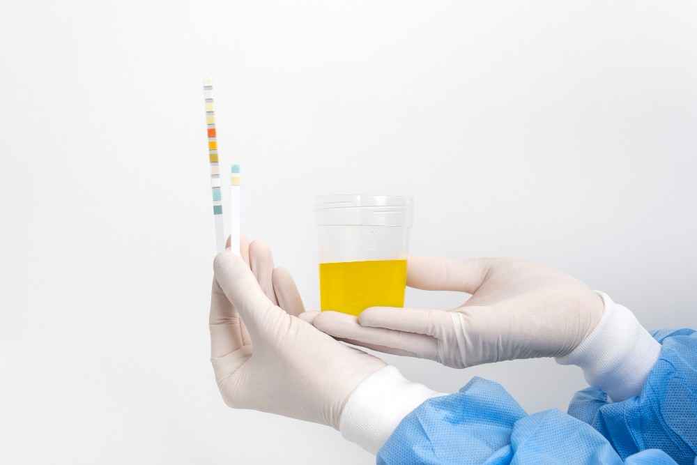 Uric Acid in Hindi - कारण, लक्षण और नियंत्रण - सभी जानकारी