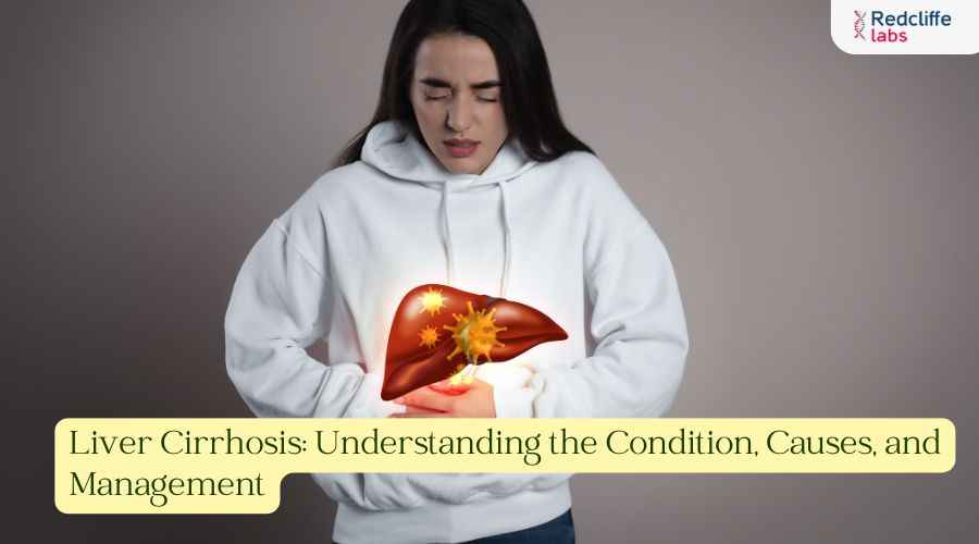 Liver Cirrhosis: Understanding the Condition, Causes, and Management