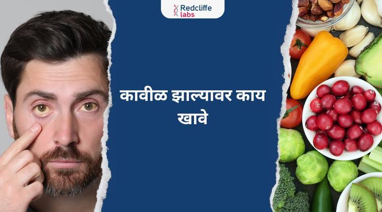 कावीळ झाल्यावर काय खावे (What to Eat After Getting Jaundice)