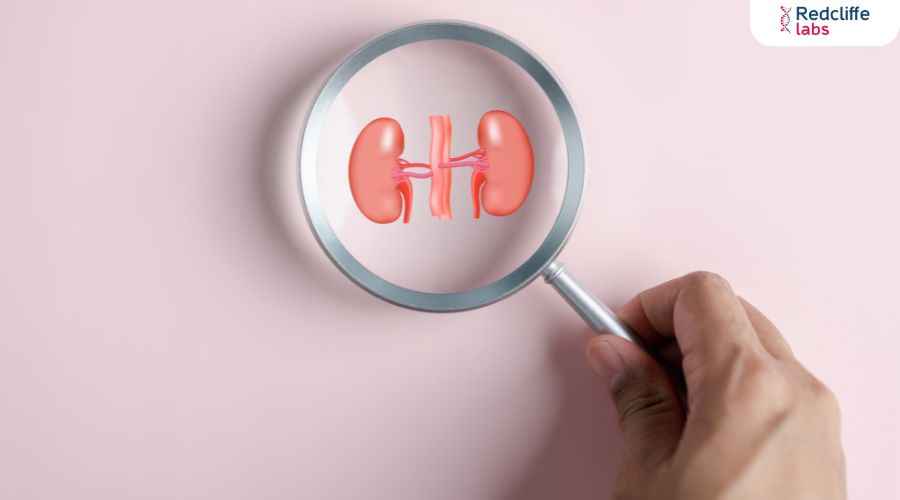 10 Benefits of Regular KFT for Monitoring Your Kidney Health