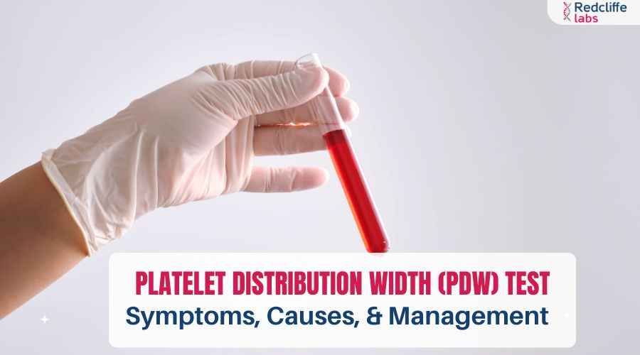 Platelet Distribution Width (PDW) Test: Symptoms, Causes, & Management