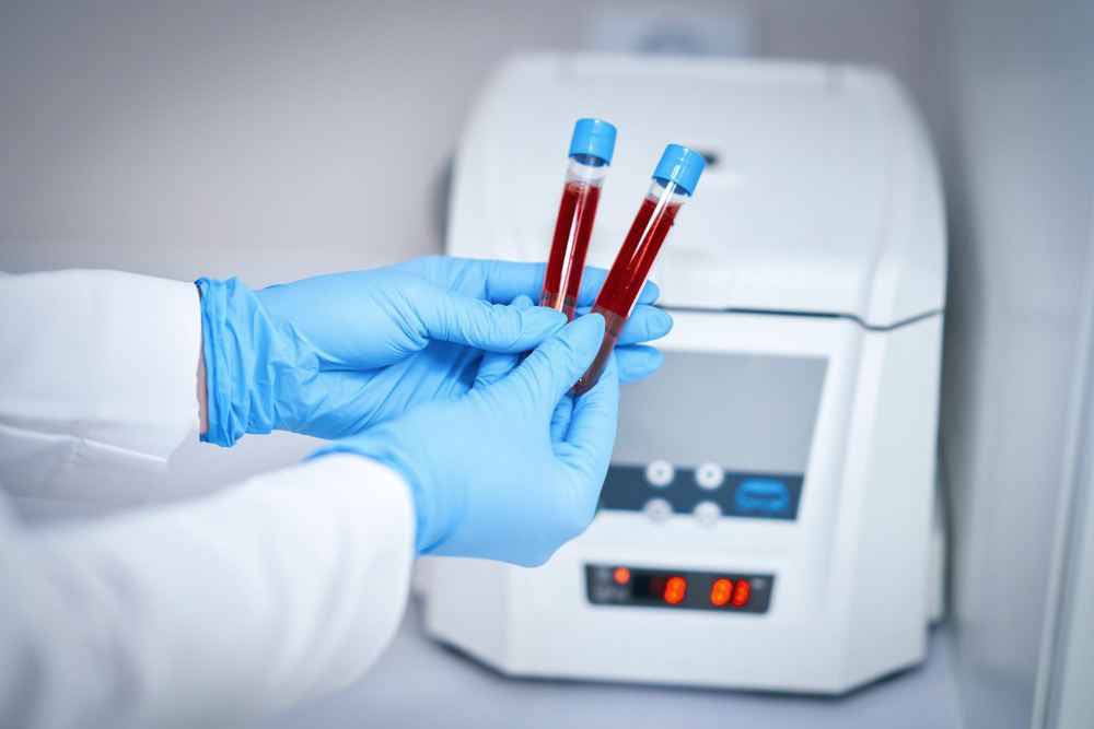 Normal Value of Serum Electrolytes: Reference Range and Importance