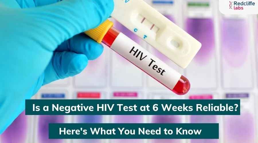 Is a Negative HIV Test at 6 Weeks Reliable? Here's What You Need to Know.